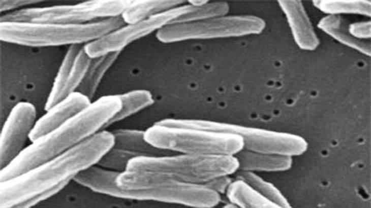 Sintetizan compuestos de hierro para tratar la tuberculosis