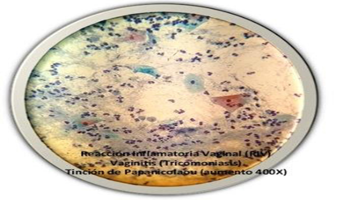 Diagnostican enfermedades sexuales y reproductivas con microscopio