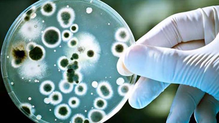 Muerte por Streptococcus Pyogenes: informe de la Facultad de Ciencias Exactas de la UNLP